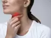 Заболявания на гърлото