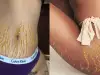 Тя има стрии! Но ги превърна в истинско произведение на изкуството