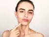 Може ли аспиринът да лекува акне?