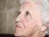 Старческите петна