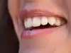 Метален вкус в устата